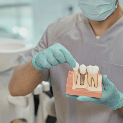 Dentist showcasing a model of dental implants at Dentistry at City Centre.